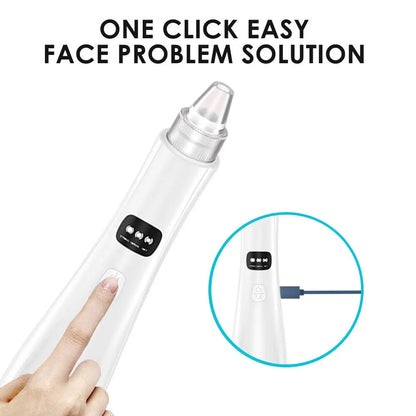 Virelia™ PurePore Vacuum-Dispositivo de limpieza facial con 3 modos de succión para eliminar puntos negros, células muertas e impurezas de la piel.