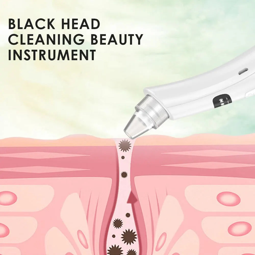 Virelia™ PurePore Vacuum-Dispositivo de limpieza facial con 3 modos de succión para eliminar puntos negros, células muertas e impurezas de la piel.