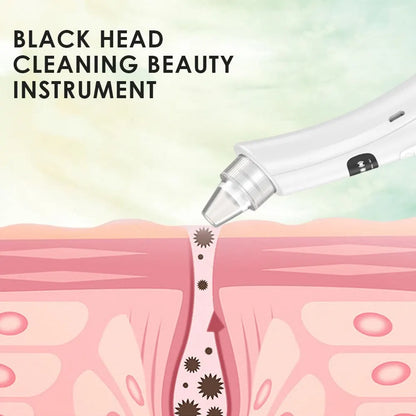 Virelia™ PurePore Vacuum-Dispositivo de limpieza facial con 3 modos de succión para eliminar puntos negros, células muertas e impurezas de la piel.